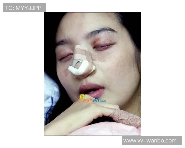 窦加星社媒分享鼻梁骨折手术后因疲惫引发哮喘的恢复经历与反思 窦加星社媒分享鼻梁骨折手术后因疲惫引发哮喘的恢复经历与反思